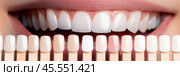 Smiling woman mouth with teeth color samples, closeup. Dental veneers. Choosing a shade of dental veneers for bleaching. Teeth whitening. Cosmetic Dentistry, dental treatment. Veneers installation. Стоковое AI-изображение, AI-художник Марина Демидюк / Фотобанк Лори