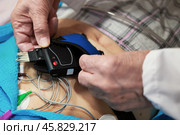 Крупный план процесса установки датчика холтеровского монитора для измерения ЭКГ. Стоковое фото, фотограф Евгений Ковальский / Фотобанк Лори