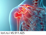 Anatomical model of the shoulder joint, focusing on its internal structure. Bones such as the scapula, clavicle, and humeral head are visible. The joint is surrounded by soft tissues including ligaments and cartilage. The area of ​​the joint is highlighted in red, symbolizing inflammation or damage, indicating possible problems such as arthritis, bursitis, or dislocation. The background is in light blue tones, emphasizing the medical and diagnostic nature of the image. Стоковое AI-изображение, AI-художник Анна Кривицкая / Фотобанк Лори