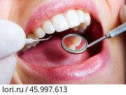 Dental examination, woman with toothache, periodontal disease in wisdom teeth, gum inflammation, dental pain, health problems concept. Стоковое AI-изображение, AI-художник Станислав Тарко / Фотобанк Лори