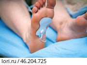 Electrode pad from a muscle stimulator attached to the sole of a foot, designed for muscle stimulation and rehabilitation. Стоковое фото, фотограф Татьяна Степанищева / Фотобанк Лори