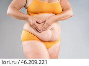 Tummy tuck, flabby skin on a fat belly, abdomen with obesity and cellulite, saggy stomach, plastic surgery concept on gray background. Стоковое фото, фотограф Станислав Тарко / Фотобанк Лори