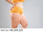 Overweight thighs, woman with fat hips and legs, obesity female body with cellulite on gray background. Стоковое фото, фотограф Станислав Тарко / Фотобанк Лори