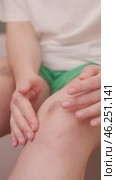 Women's legs with noticeable bruises, a possible sign of vitamin deficiency or weak blood vessels. Стоковое видео, видеограф Svetlana Golovco / Фотобанк Лори