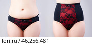 Woman's body before and after weight loss, flabby belly after pregnancy, fat woman in corrective panties on grey background. Стоковое фото, фотограф Станислав Тарко / Фотобанк Лори