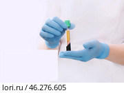 PRP therapy. Medical vial in doctor's hands. Стоковое фото, фотограф Ольга Зиновская / Фотобанк Лори