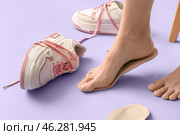 Female legs fitting orthopedic insoles near sneakers on lilac background, closeup. Стоковое фото, фотограф Pixel_shot / Фотобанк Лори