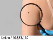 Dermatologist with magnifier examining mole on woman's shoulder against grey background, back view. Стоковое фото, фотограф Pixel_shot / Фотобанк Лори