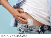 Young man with medical patch after appendix surgery on blue background, closeup. Стоковое фото, фотограф Pixel_shot / Фотобанк Лори