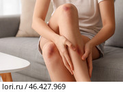 Young woman with bruised legs sitting on sofa at home, closeup. Стоковое фото, фотограф Pixel_shot / Фотобанк Лори