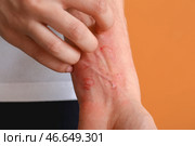 Женщина с красной загорелой кожей на цветном фоне, крупным планом. Стоковое фото, фотограф Pixel_shot / Фотобанк Лори