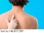 Дерматолог осматривает родинку на спине молодого человека на фоне синего фона, крупным планом. Стоковое фото, фотограф Pixel_shot / Фотобанк Лори