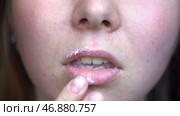 Close up of woman fingers applying ointment onto lips, treatment of herpes infection and virus. Стоковое фото, фотограф David Kashakhi / Фотобанк Лори