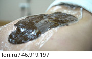 Close up for a patient lying on a bed with hot therapeutic mud on his back, alternative medicine concept. Стоковое фото, фотограф David Kashakhi / Фотобанк Лори
