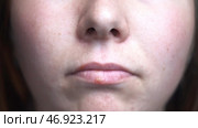 Female face details with the virus spots, concept of medicine and illnesses. Стоковое фото, фотограф David Kashakhi / Фотобанк Лори