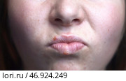 Female face details with the virus spots, concept of medicine and illnesses. Стоковое фото, фотограф David Kashakhi / Фотобанк Лори
