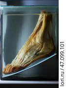 April 1, 2023. Belarus, Minsk. Exhibition of anatomical exhibits. The frostbitten part of a human leg is presented as an anatomical exhibit preserved in alcohol in a formaldehyde solution.Museum exhibit. Редакционное фото, фотограф Лазаренко Светлана / Фотобанк Лори