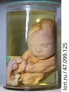 April 1, 2023 Belarus, Minsk.Exhibition of anatomical exhibits. Human infant with pathological development of dropsy. Elephant child. Exhibits of the Museum of Anthropology and Ethnography. Редакционное фото, фотограф Лазаренко Светлана / Фотобанк Лори