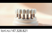 Dental implants for healthy and beautiful smile. Dental implants made of metal covered with crowns that look like natural teeth are installed in a row on gum. Стоковое AI-изображение, AI-художник Iva Noel / Фотобанк Лори