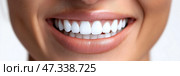 Bright white smile showcases healthy teeth and gums in clean backdrop. Яркая белоснежная улыбка демонстрирует здоровые зубы и десны на чистом фоне. Стоковое AI-изображение, AI-художник Katsiaryna Repich / Фотобанк Лори