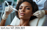 Microneedling treatment for skin rejuvenation in a clinic setting during daylight hours. Стоковое AI-изображение, AI-художник Сергей Толмачёв / Фотобанк Лори