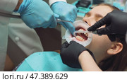 Dental team rinsing and preparing patients teeth for aligner bonding in orthodontic procedure. Стоковое видео, видеограф Дмитрий Наумов / Фотобанк Лори