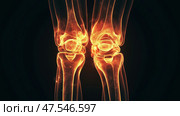 Orange and glowing anatomical representation of two knee joints. Оранжевое и светящееся анатомическое изображение двух коленных суставов. Стоковое AI-изображение, AI-художник Katsiaryna Repich / Фотобанк Лори
