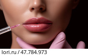 Close-Up of Lip Filler Injection – Needle and Syringe Procedure on Woman's Lips. Филлер для губ - один из самых популярных видов дермальных наполнителей, которые вводятся в губы женщины иглой и шприцем крупным планом. Стоковое AI-изображение, AI-художник Katsiaryna Repich / Фотобанк Лори