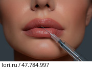 Close-Up of Lip Filler Injection – Needle and Syringe Procedure on Woman's Lips. Филлер для губ - один из самых популярных видов дермальных наполнителей, которые вводятся в губы женщины иглой и шприцем крупным планом. Стоковое AI-изображение, AI-художник Katsiaryna Repich / Фотобанк Лори