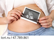 Ultrasound picture pregnant baby photo. Woman holding ultrasound pregnancy sonogram picture of unborn baby inside her big belly. Concept of pregnancy, maternity, expectation for baby birth. Стоковое фото, фотограф Ирина Михайличенко / Фотобанк Лори