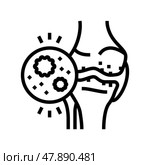 infectious arthritis line icon vector illustration. Стоковая иллюстрация, иллюстратор Vectorwin / Фотобанк Лори