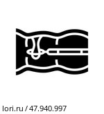 colon polyps gastroenterologist glyph icon vector illustration. Стоковая иллюстрация, иллюстратор Vectorwin / Фотобанк Лори