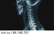 Dynamic cervical xray sequence revealing spinal alignment and anatomical structures. Стоковое AI-видео, аниматор Владимир Федоров / Фотобанк Лори