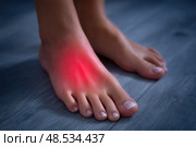 Joint diseases, hallux valgus, plantar fasciitis, woman's leg hurts, pain in the foot, female feet closeup, health problems concept. Стоковое AI-изображение, AI-художник Станислав Тарко / Фотобанк Лори