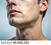 A man with a serious expression displays visible scars along his jawline, suggesting a significant past injury or surgical intervention. Стоковое AI-изображение, AI-художник Ольга Игнашина / Фотобанк Лори