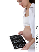 Pregnant woman looking at x-ray of baby. Стоковое фото, агентство Ingram Publishing / Фотобанк Лори