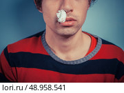 Young man with tissue in his nostril has nose bleed as well as cold sores on his lip. Стоковое фото, агентство Ingram Publishing / Фотобанк Лори