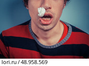 Young man with tissue in his nostril has nose bleed as well as cold sores on his lip. Стоковое фото, агентство Ingram Publishing / Фотобанк Лори