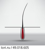 hair follicle treatment design. Стоковая иллюстрация, агентство Ingram Publishing / Фотобанк Лори