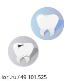 Healthy and diseased tooth design cartoon. Icons or sign, symbol of two teeth. Tooth with a hole or crack damaged.  Caries disease and care healthy medicine flat style concept. Vector illustration. Стоковая иллюстрация, агентство Ingram Publishing / Фотобанк Лори
