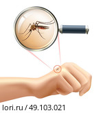 Mosquito on hand. Realistic composition with human hand and mosquito in magnifying glass zoom vector illustration. Стоковая иллюстрация, агентство Ingram Publishing / Фотобанк Лори