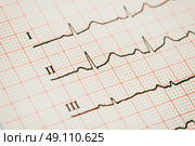 Sinus Heart Rhythm On Electrocardiogram Record Paper. Стоковое фото, агентство Ingram Publishing / Фотобанк Лори