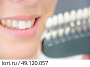 Lady smiling next to teeth samples. Стоковое фото, агентство Ingram Publishing / Фотобанк Лори