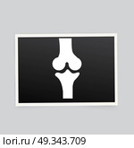X-ray of the knee. Vector illustration. Стоковая иллюстрация, агентство Ingram Publishing / Фотобанк Лори