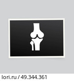 X-ray of the knee. Vector illustration. Стоковая иллюстрация, агентство Ingram Publishing / Фотобанк Лори