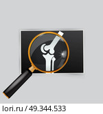 X-ray of the knee magnifying glass search. Стоковая иллюстрация, агентство Ingram Publishing / Фотобанк Лори