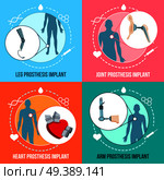 Prothesis medical implants concept flat icons square set with orthopedic leg and joints replacement isolated vector illustration . Prothesis Implants Flat Concept. Стоковая иллюстрация, агентство Ingram Publishing / Фотобанк Лори