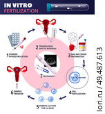 Colored flat in vitro fertilization IVF  infographics with steps from ovarian huperstimulation to pregnancy vector illustration. Стоковая иллюстрация, агентство Ingram Publishing / Фотобанк Лори