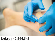 Close-up of a needle and hands of physiotherapist doing a dry needling in a physiotherapy center.. Hands of physiotherapist doing a dry needling. Стоковое фото, агентство Ingram Publishing / Фотобанк Лори