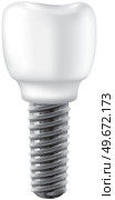 Realistic white dental implant, denture. Dentistry, medicine and health concept. Denture construction, dental implant. Instrument for replacement of diseased tooth. Screw retained for teeth implants. Instrument for replacement of diseased tooth. Screw dental implant, denture construction, prosthesis. Стоковая иллюстрация, агентство Ingram Publishing / Фотобанк Лори